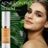2727-rdalch0002.1.td_size_1 RD Alchemy Acne Control Serum