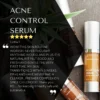 2727-rdalch0002.3.td_size_1 RD Alchemy Acne Control Serum