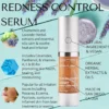 2727-rdalch0055.2.td_size_1 RD Alchemy Redness Control Serum